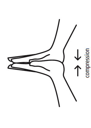 Aggregation involves the compression of result rows